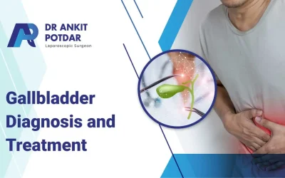 Gallbladder Diagnosis and Treatment : A Comprehensive Guide