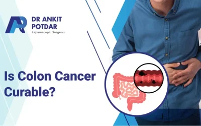 Is Colon Cancer Curable? Learn About Treatment Options Here