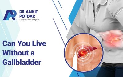 Can You Live a Healthy Life Without a Gallbladder?