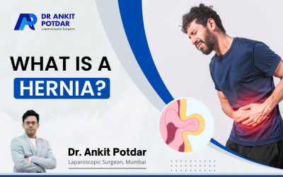 What Is a Hernia?