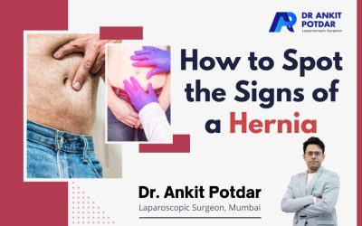 How to Spot the Signs of a Hernia