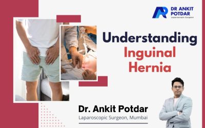 What is Inguinal Hernia?