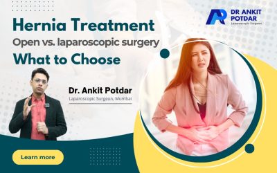 Hernia Treatment : Open vs. Laparoscopic Surgery
