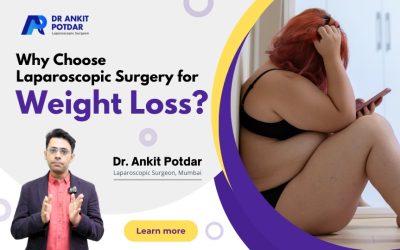 Why Choose Laparoscopic Surgery for Weight Loss?