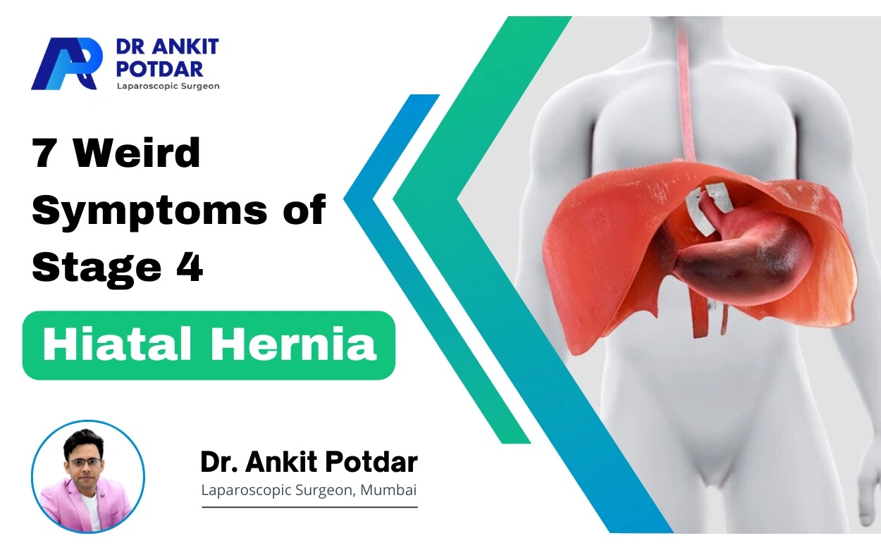 7 symptoms of hiatus hernia