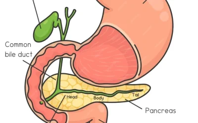 Symptoms of Gallbladder Stones ?